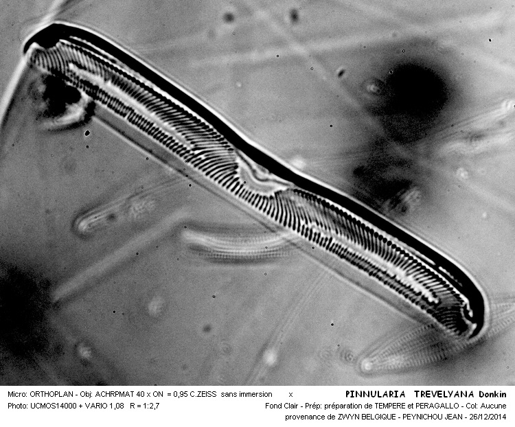 PINNULARIA TREVELYANA #40198