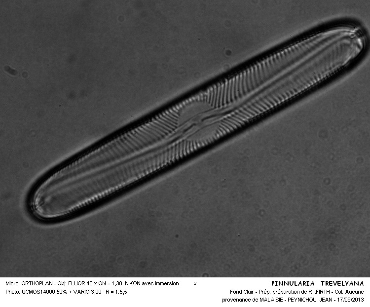 PINNULARIA TREVELYANA #33829
