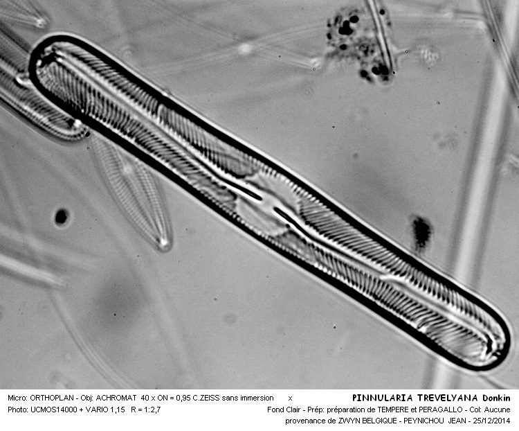 PINNULARIA TREVELYANA #40190