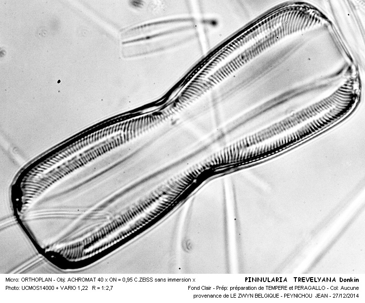 PINNULARIA TREVELYANA #40213