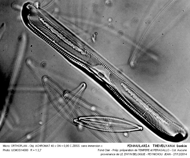 PINNULARIA TREVELYANA #40214