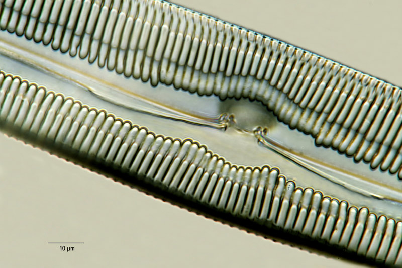 Pinnularia viridis #13201