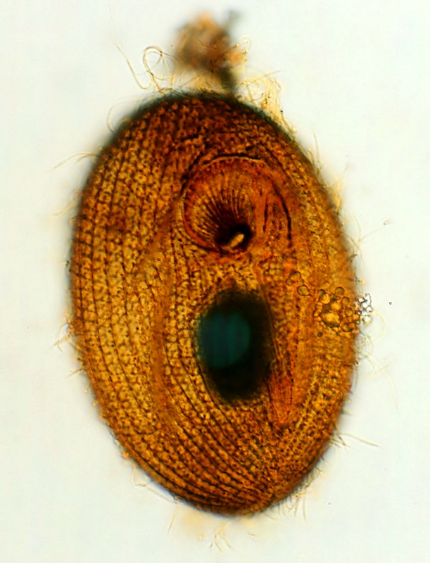 Pleuronema (cilié voilé) #43822