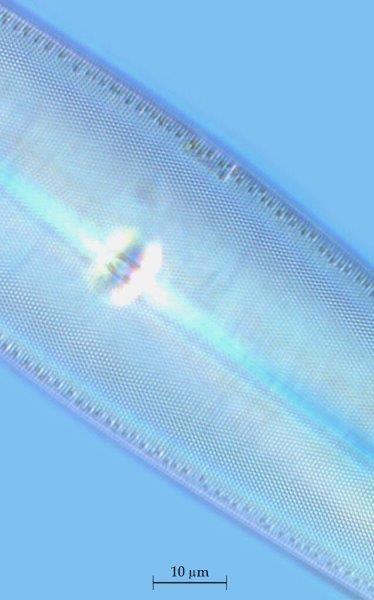 Pleurosigma rigidum #53819