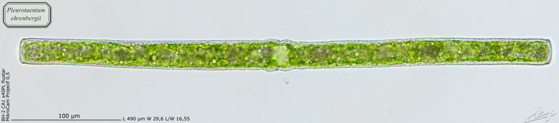 Pleurotaenium ehrenbergii (Ralfs) De Bary 1858 #66141