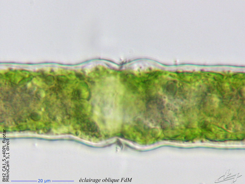 Pleurotaenium ehrenbergii (Ralfs) De Bary 1858 #66145