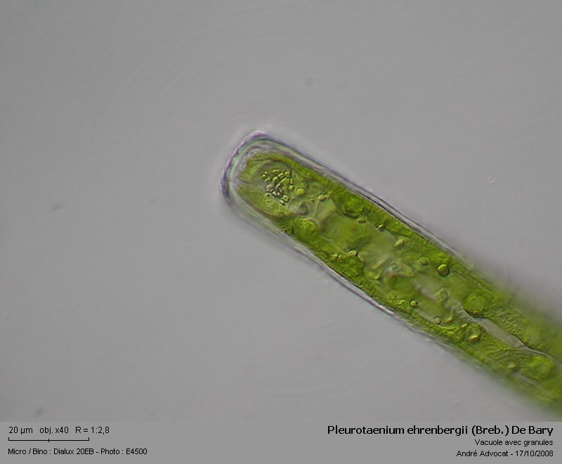 Pleurotaenium ehrenbergii (Breb.) De Bary var. Ehrenberg #6155
