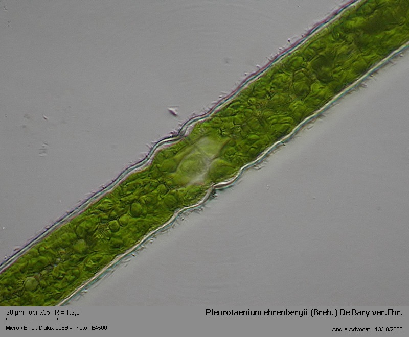 Pleurotaenium ehrenbergii (Breb.) De Bary var. Ehrenberg #6057