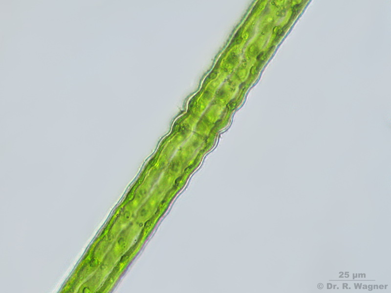 Pleurotaenium ehrenbergii #4867