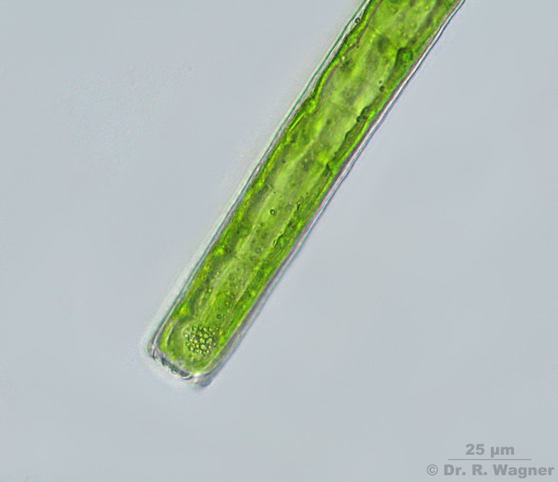 Pleurotaenium ehrenbergii #4868