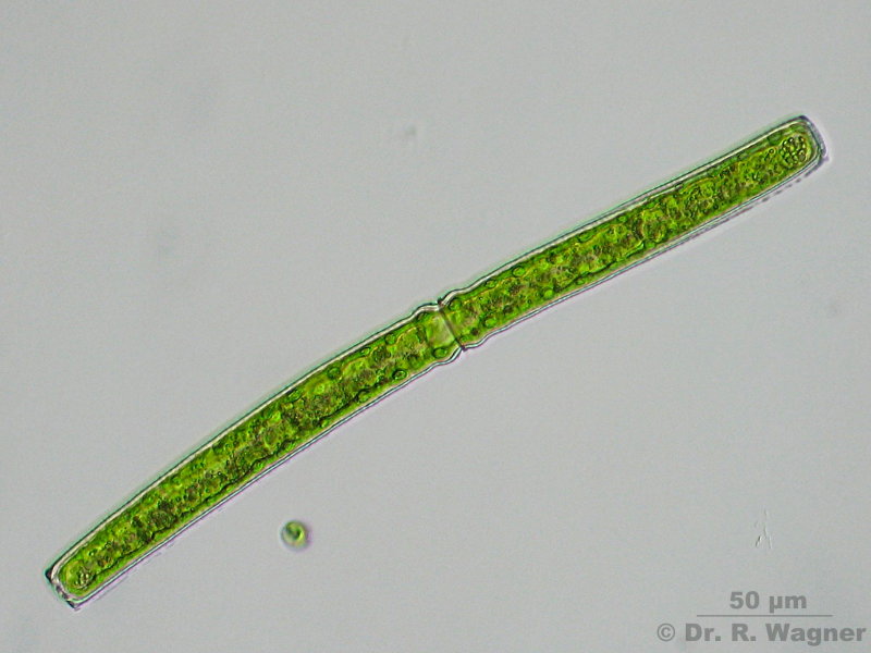 Pleurotaenium ehrenbergii #4866