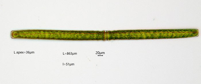 Pleurotaenium maximum #76754
