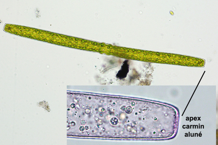 Pleurotaenium trabecula #76872