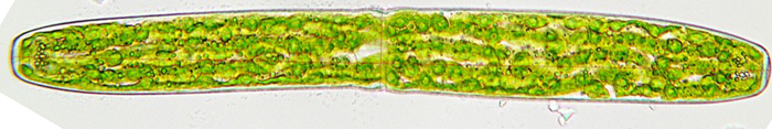 Pleurotaenium trabecula #76875