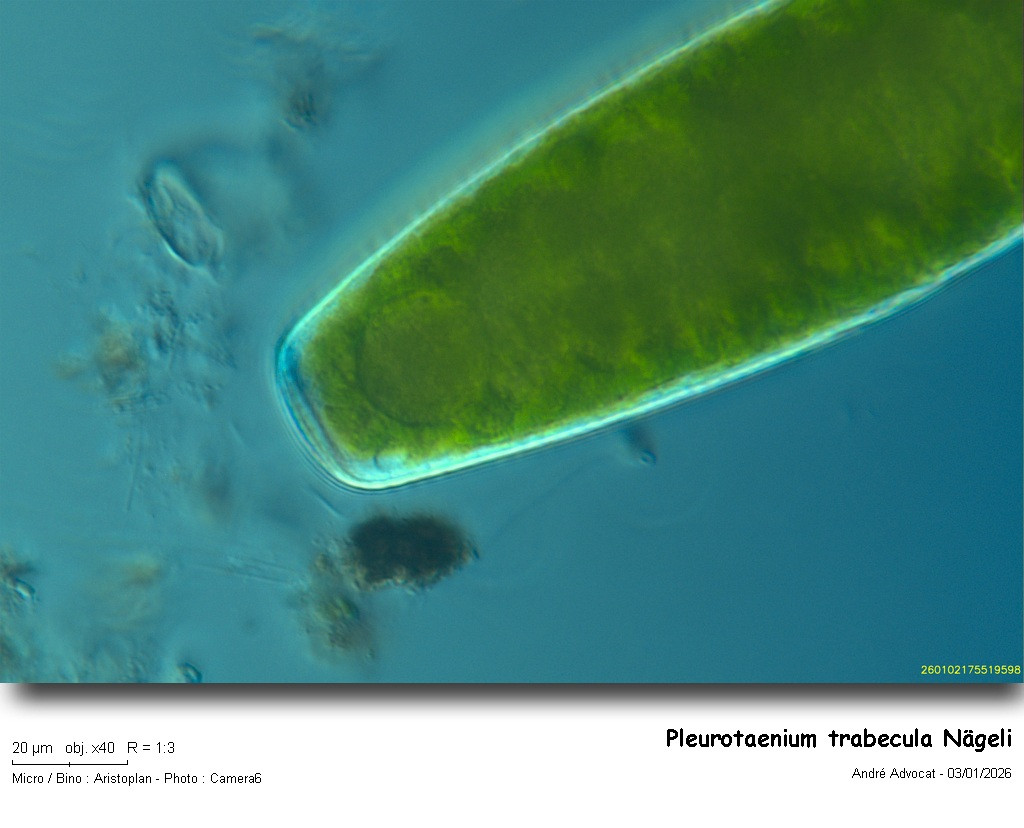 Pleurotaenium trabecula #84761
