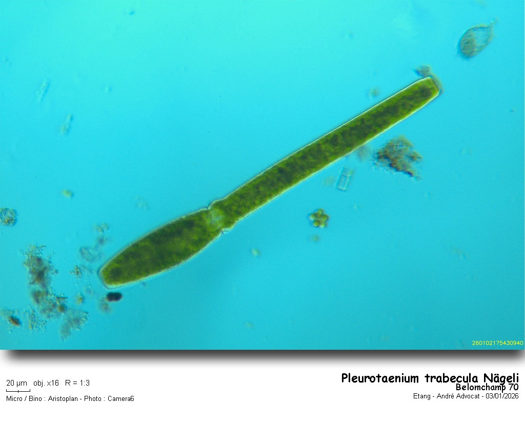 Pleurotaenium trabecula #84760