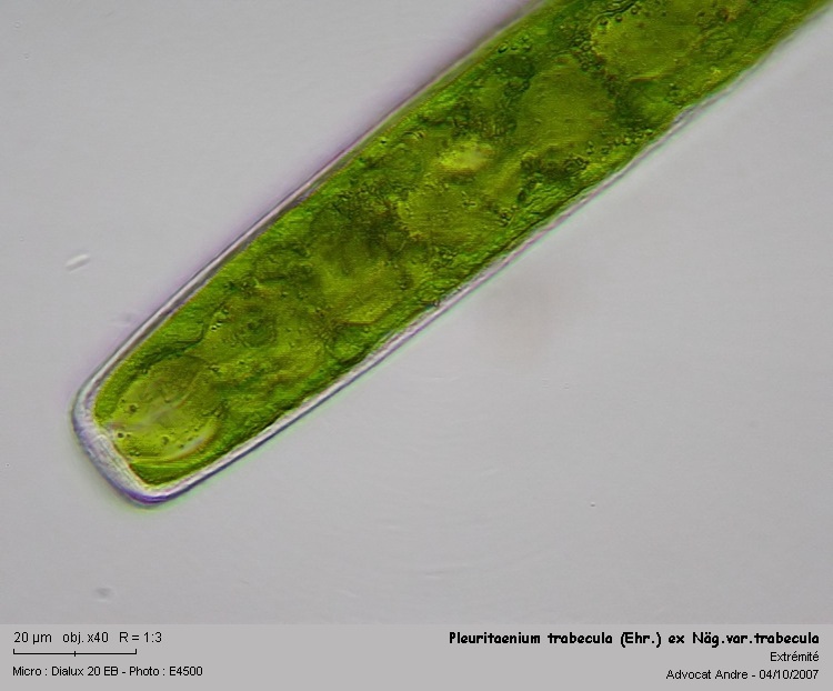 Pleurotaenium trabecula #220