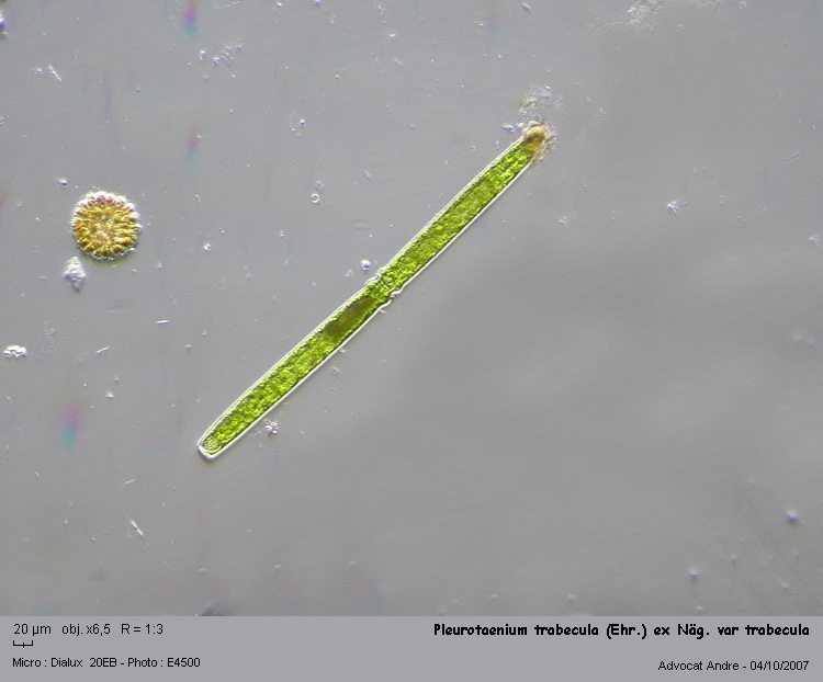 Pleurotaenium trabecula #218
