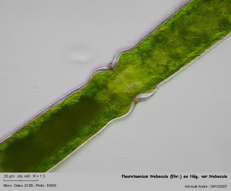 Pleurotaenium trabecula #219