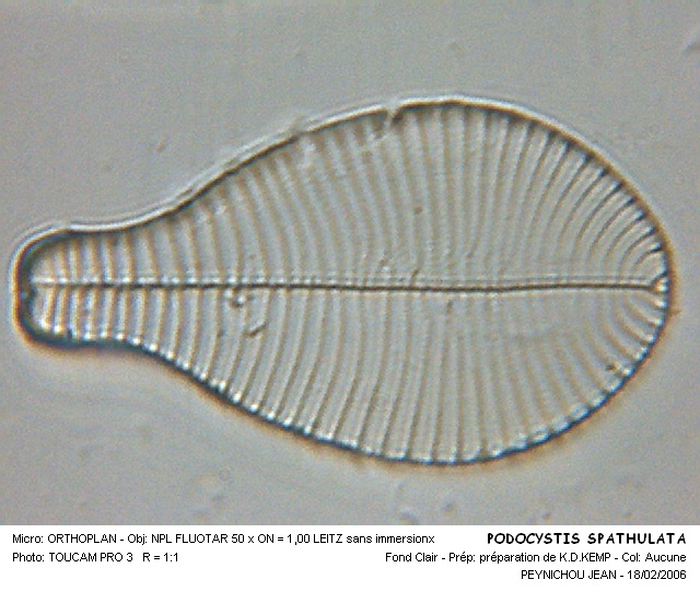 PODOCYSTIS SPATHULATA #31666