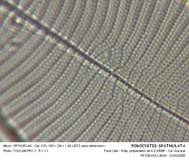 PODOCYSTIS SPATHULATA #31667