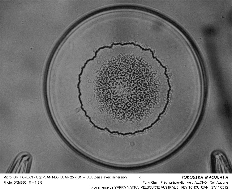 Podosira stelliger (Bail.) Mann #31665