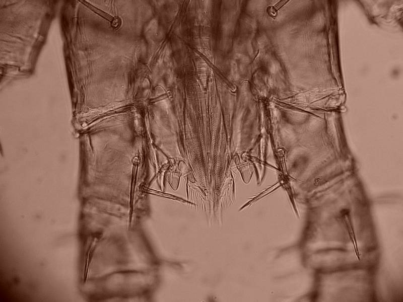 Poecilochirus necrophori - Deutonymphe - Acarien #17583