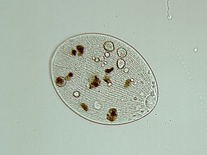 Prorodon teres Ehremberg, 1838 #16410