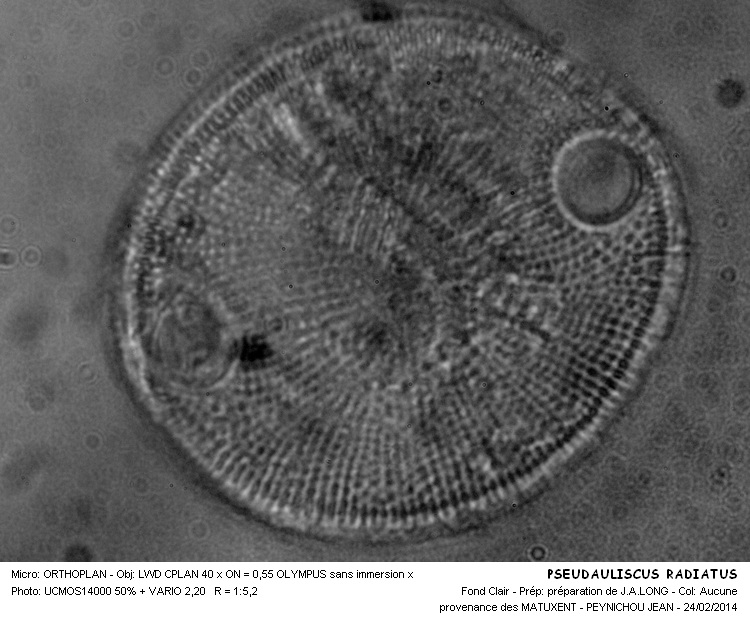 PSEUDAULISCUS RADIATUS #36492