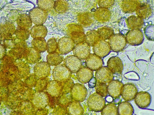 Pseudephemerum nitidum (Hedw.) Loeske #65851
