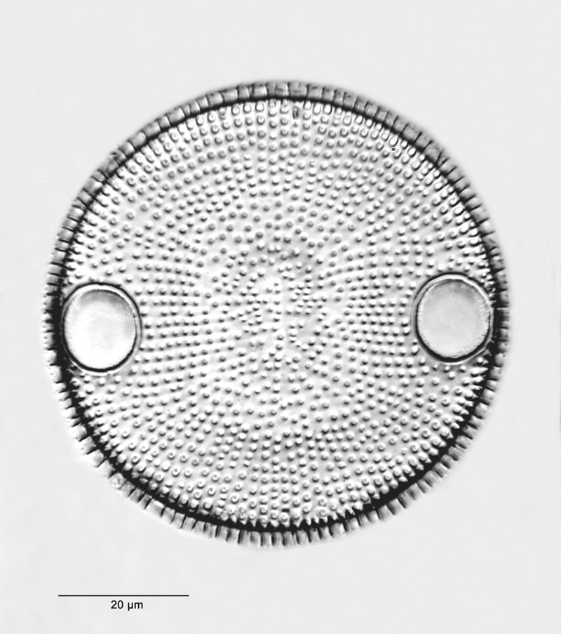Pseudoauliscus radiatus #48395