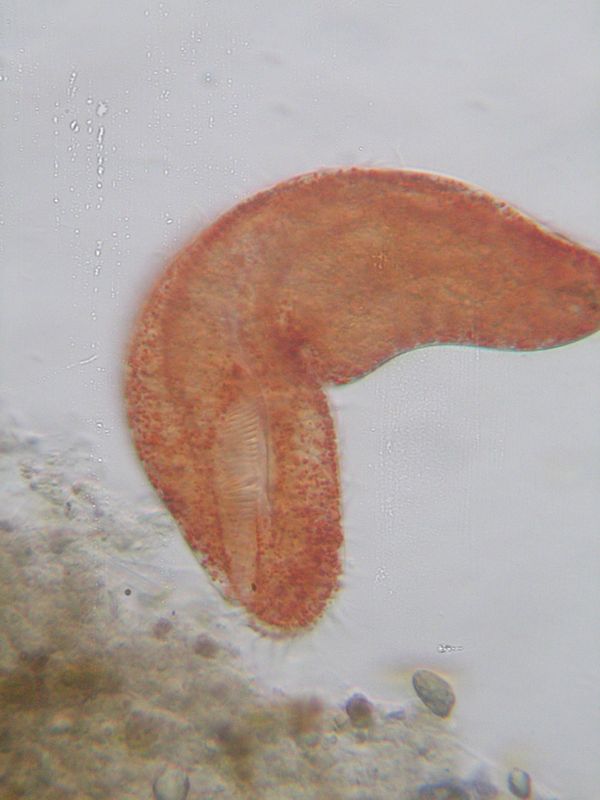 Pseudokeronopsis : un superbe cilié rouge #20495