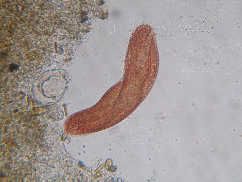 Pseudokeronopsis : un superbe cilié rouge #20493