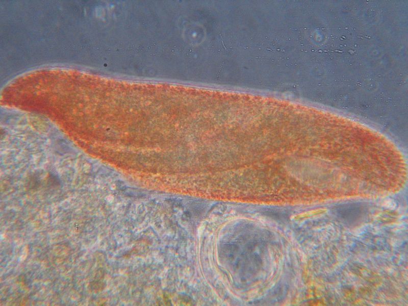 Pseudokeronopsis : un superbe cilié rouge #20496