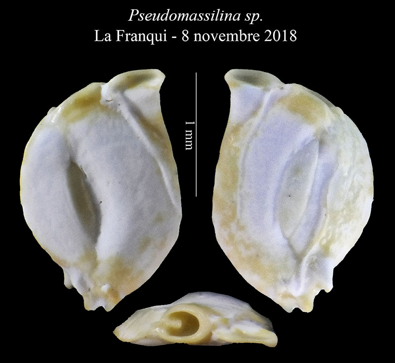 Pseudomassilina sp #58222