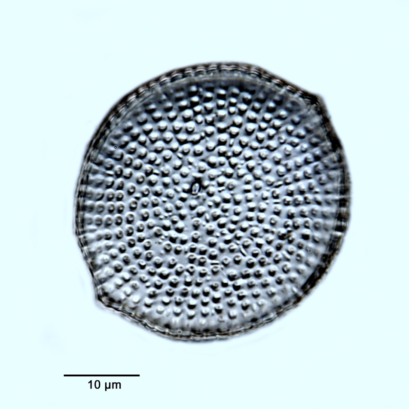 Pseudostictodiscus angulatus (Grunow) Grunow #36211