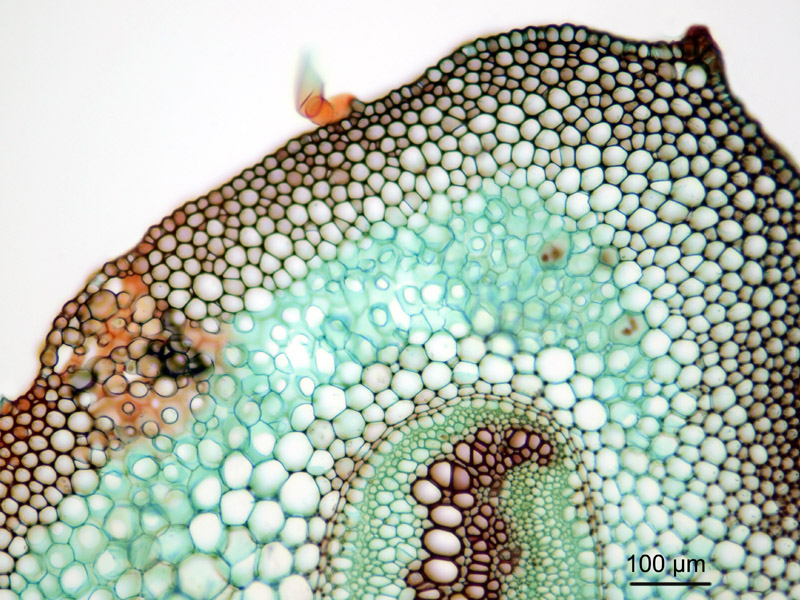 Pteridium aquilinum, histologie. #16060
