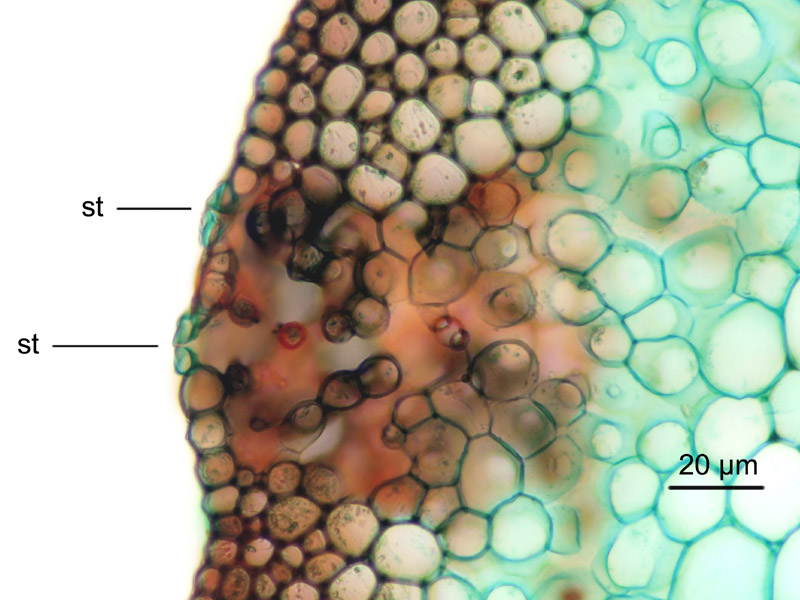 Pteridium aquilinum, histologie. #16061