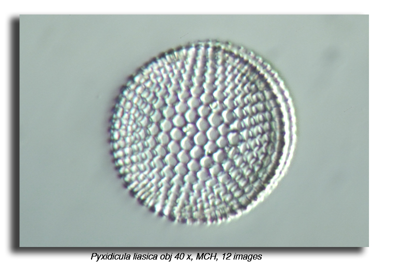 Pyxidicula liasica #20255