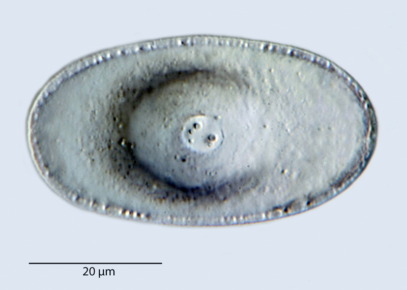 Quadrocistella rectagonuma Suto #41475