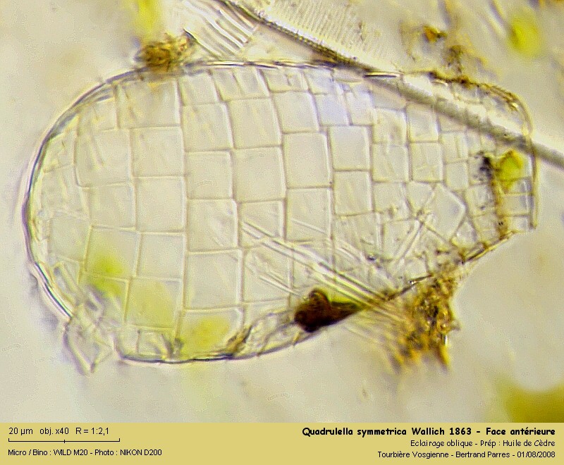 Quadrulella symmetrica Wallich 1863. #5033
