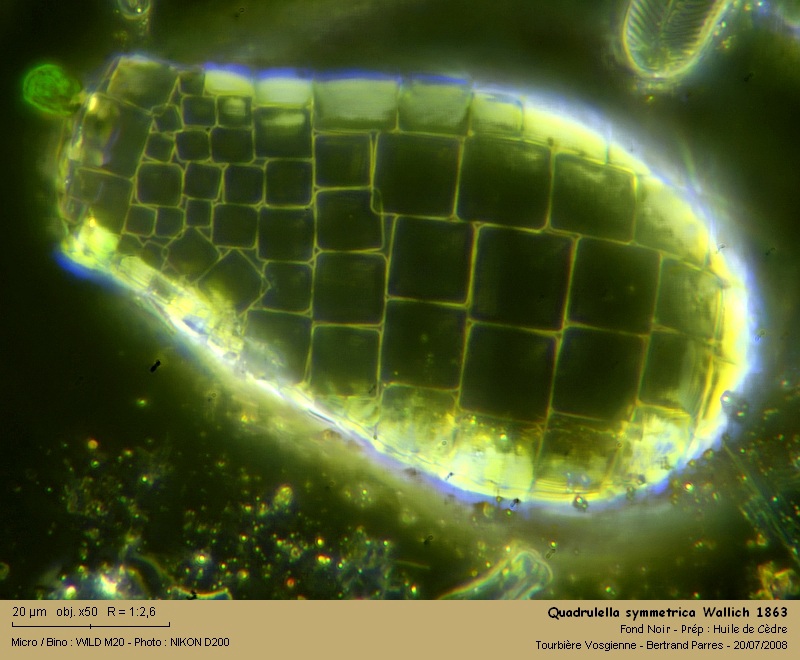 Quadrulella symmetrica Wallich 1863. #5034