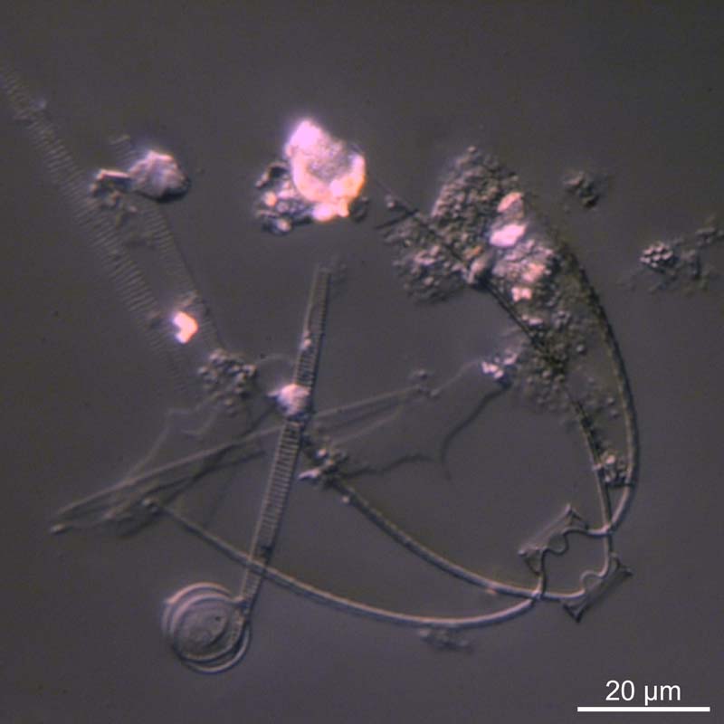 quelques Chaetoceros sp. #47545
