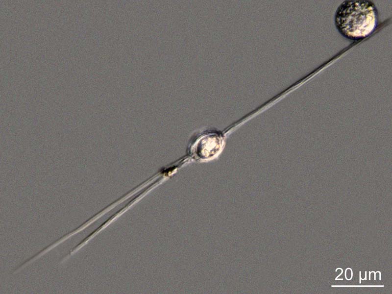 quelques Chaetoceros sp. #47539