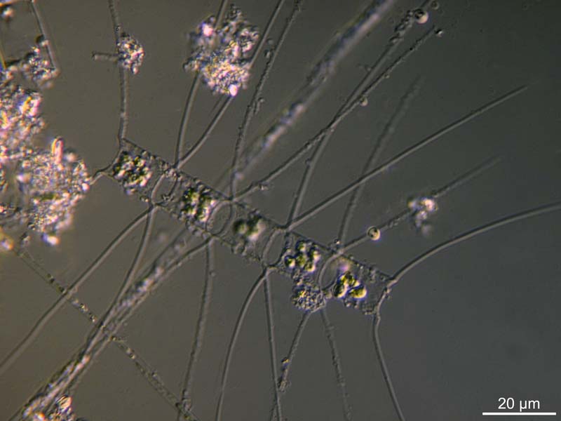 quelques Chaetoceros sp. #47547