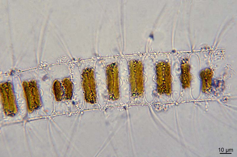quelques Chaetoceros sp. #47543