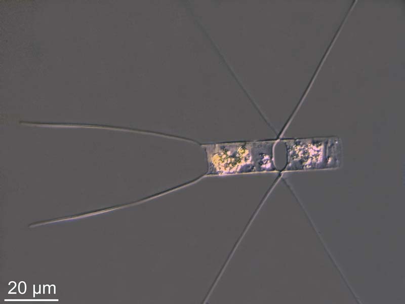 quelques Chaetoceros sp. #47546