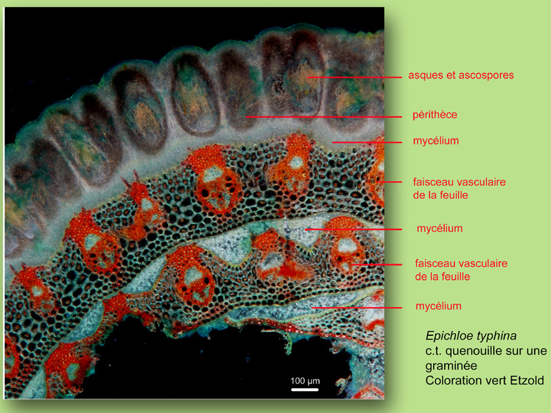Quenouille des graminées, histologie, histology #22847