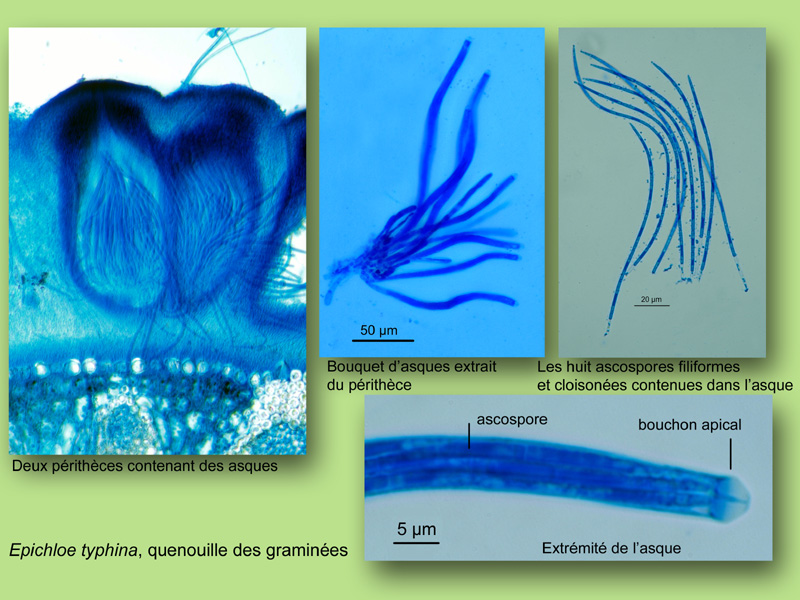 Quenouille des graminées, histologie, histology #22848