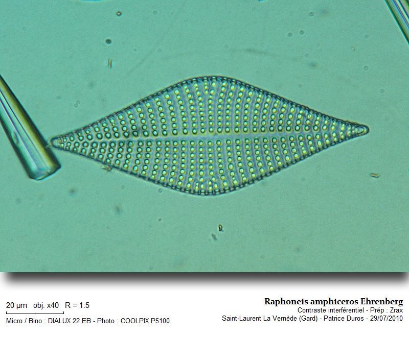 Raphoneis amphiceros Ehrenberg #18773